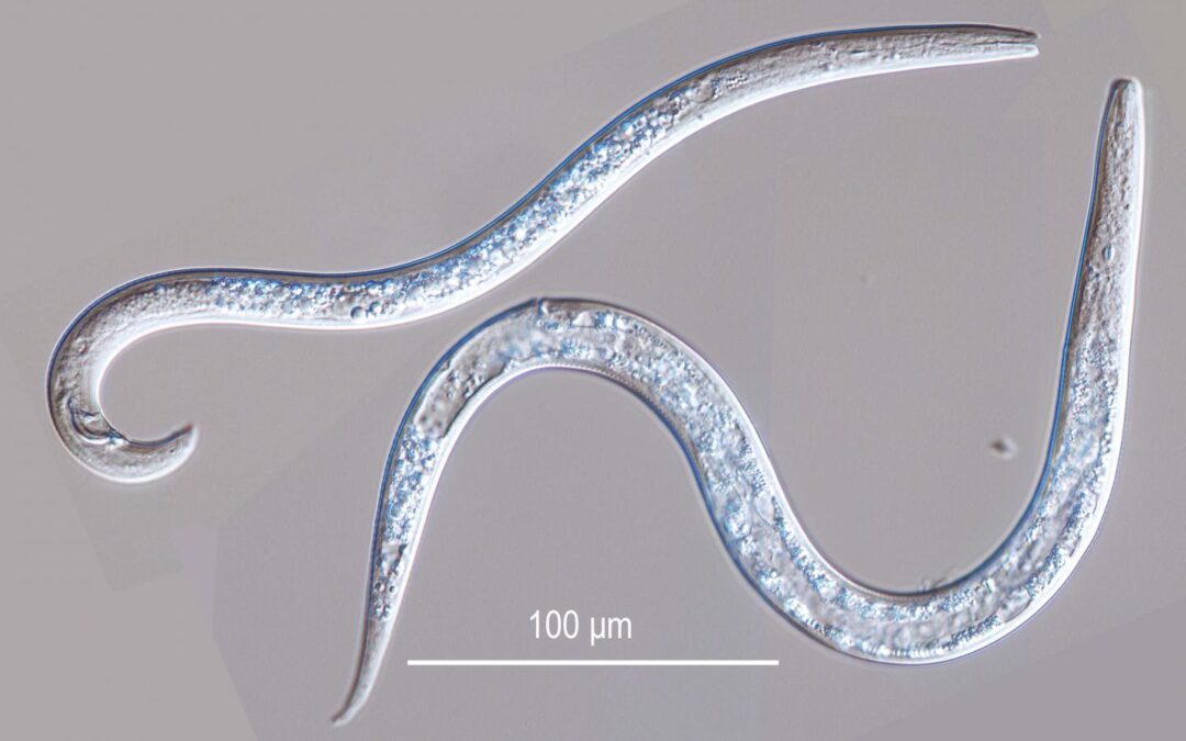 parasite worm symptoms remedy cleanse humans stomach